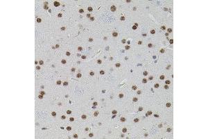 Immunohistochemistry (IHC) image for anti-SMAD, Mothers Against DPP Homolog 5 (SMAD5) (AA 140-240) antibody (ABIN1682808)