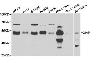 Western blot analysis of extracts of various cell lines, using XIAP antibody. (XIAP antibody)