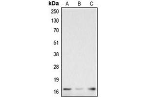 Western blot analysis of Caspase 3 p17 expression in HeLa LPS-treated (A), Raw264. (Caspase 3 p17 (Center) antibody)