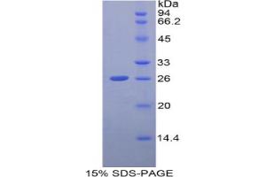 SDS-PAGE analysis of Human GCLC Protein. (GCLC Protein)