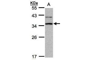 WB Image Sample A: 30μg of Raji whole cell lysate , 12% SDS PAGE antibody diluted at 1:1000 (XRCC2 antibody  (N-Term))
