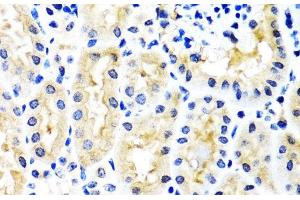 Immunohistochemistry of paraffin-embedded Mouse kidney using SNAP29 Polyclonal Antibody at dilution of 1:100 (40x lens). (SNAP29 antibody)