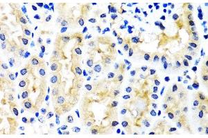 Immunohistochemistry of paraffin-embedded Mouse kidney using SNAP29 Polyclonal Antibody at dilution of 1:100 (40x lens). (SNAP29 antibody)