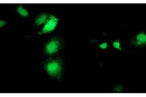 Anti-SEC14L2 mouse monoclonal antibody (ABIN2455150) immunofluorescent staining of COS7 cells transiently transfected by pCMV6-ENTRY SEC14L2 (RC215994). (SEC14L2 antibody)