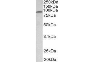 ABIN2563856 (1µg/ml) staining of Human Heart lysate (35µg protein in RIPA buffer).