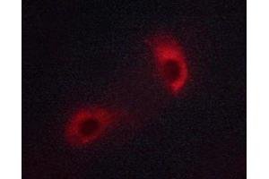 ABIN6267313 staining Jurkat cells by ICC/IF. (LCK antibody  (pTyr393))