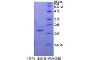 SDS-PAGE analysis of Human TAF12 Protein. (TAF12 Protein)
