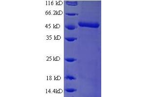 SDS-PAGE (SDS) image for Defective in Cullin Neddylation 1, Domain Containing 1 (DCUN1D1) (AA 1-259), (full length) protein (His-SUMO Tag) (ABIN5711581)