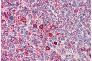 Human Spleen (formalin-fixed, paraffin-embedded) stained with BCL11A antibody ABIN462216 followed by biotinylated goat anti-rabbit IgG secondary antibody ABIN481713, alkaline phosphatase-streptavidin and chromogen. (BCL11A antibody  (N-Term))