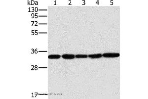 Western blot analysis of Human testis tissue and K562 cell, PC3 cell and human liver cancer tissue, hela cell, using MTCH2 Polyclonal Antibody at dilution of 1:400 (MTCH2 antibody)