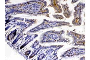IHC analysis of Xanthine Oxidase using anti-Xanthine Oxidase antibody . (XDH antibody  (AA 2-343))