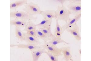 ICC testing of human A549 cells with Beta Catenin antibody. (beta Catenin antibody  (AA 2-233))