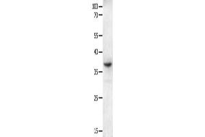 Gel: 10 % SDS-PAGE, Lysate: 40 μg, Lane: Mouse intestinum tenue tissue, Primary antibody: ABIN7190854(GPR6 Antibody) at dilution 1/250, Secondary antibody: Goat anti rabbit IgG at 1/8000 dilution, Exposure time: 2 minutes (GPR6 antibody)