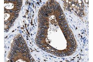 ABIN6266881 at 1/100 staining human Colorectal tissue sections by IHC-P. (HDAC5 antibody  (C-Term))