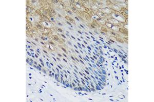 Immunohistochemistry of paraffin-embedded Human esophageal using PSPC1 Rabbit pAb (ABIN6132925, ABIN6146363, ABIN6146364 and ABIN6224928) at dilution of 1:100 (40x lens). (PSPC1 antibody  (AA 1-70))