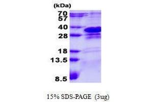 Figure annotation denotes ug of protein loaded and % gel used. (CHMP1A Protein)
