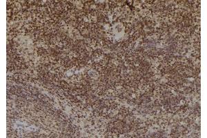 ABIN6269033 at 1/100 staining Mouse spleen tissue by IHC-P. (TYR antibody)