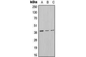 Western blot analysis of MT-ND2 expression in HepG2 (A), Raw264. (MT-ND2 antibody  (Center))