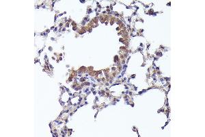 Immunohistochemistry of paraffin-embedded mouse lung using CRCP Rabbit pAb (ABIN1679351, ABIN3019127, ABIN3019128 and ABIN6220728) at dilution of 1:200 (40x lens). (CRCP antibody  (AA 1-115))