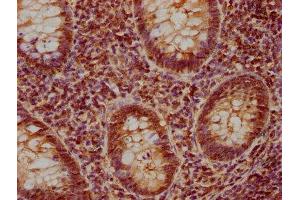 IHC image of ABIN7140126 diluted at 1:840 and staining in paraffin-embedded human appendix tissue performed on a Leica BondTM system. (STK4 antibody  (AA 6-24))