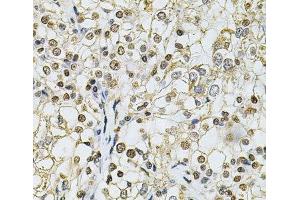 Immunohistochemistry (Paraffin-embedded Sections) (IHC (p)) image for anti-Interferon, gamma-Inducible Protein 16 (IFI16) antibody (ABIN7257561)