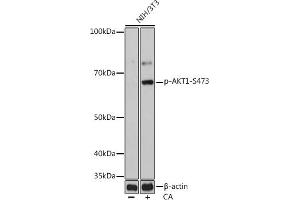 Western blot analysis of extracts of NIH/3T3 cells, using Phospho--S473 mAb (ABIN6135179, ABIN6135970, ABIN6135971 and ABIN7101880) at 1:1000 dilution. (AKT1 antibody  (pSer473))
