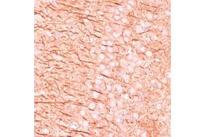 Immunohistochemistry of paraffin-embedded rat brain using M antibody (ABIN1680751, ABIN3015149, ABIN3015150 and ABIN6213853) at dilution of 1:100 (40x lens). (MAP2 antibody  (AA 260-559))