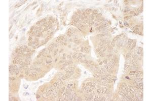 anti-Kinesin Family Member 2C (KIF2C) (AA 50-100) antibody