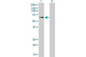 Western Blot analysis of ALPL expression in transfected 293T cell line by ALPL monoclonal antibody (M01), clone 4H1. (ALPL antibody  (AA 91-200))