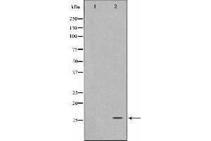 FHIT antibody  (Internal Region)