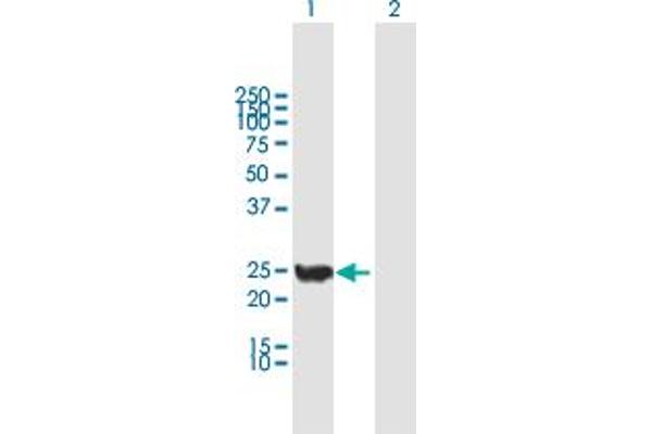 CINP antibody  (AA 1-212)