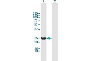 Western Blot analysis of CINP expression in transfected 293T cell line by CINP MaxPab polyclonal antibody.
