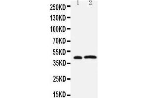 Anti-Leupaxin antibody, Western blotting Lane 1: Rat Thymus Tissue Lysate Lane 2: JURKAT Cell Lysate (Leupaxin antibody  (N-Term))