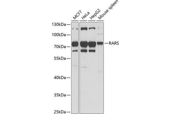 RARS antibody  (AA 1-300)