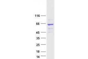 Validation with Western Blot (RASGRP2 Protein (Transcript Variant 2) (Myc-DYKDDDDK Tag))