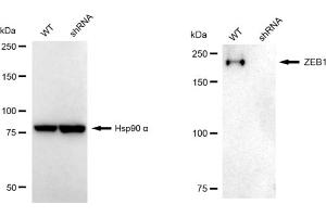 Western blotting analysis using ZEB1 antibody (ABIN7800892).
