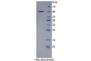 SDS-PAGE (SDS) image for Protein tyrosine Phosphatase, Receptor Type, C (PTPRC) (AA 193-575) protein (His tag) (ABIN1080601)