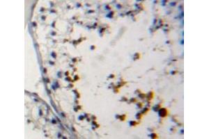 #VALUE! (PRM2 antibody  (AA 2-100))