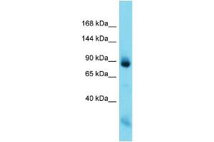 Host: Rabbit  Target Name: Nefm  Sample Tissue: Rat Muscle lysates  Antibody Dilution: 1.