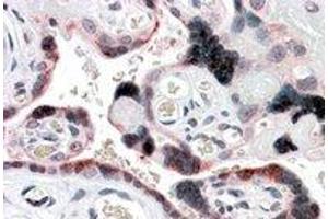 Immunohistochemistry (IHC) image for anti-Ellis Van Creveld Syndrome 2 (EVC2) (C-Term) antibody (ABIN2465666) (EVC2 antibody  (C-Term))