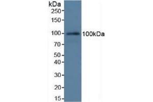 Detection of C7 in Rat Serum using Polyclonal Antibody to Complement Component 7 (C7) (C7 antibody  (AA 1-144))