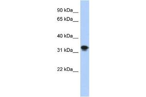 WB Suggested Anti-CENPP Antibody Titration: 0. (CENPP antibody  (N-Term))