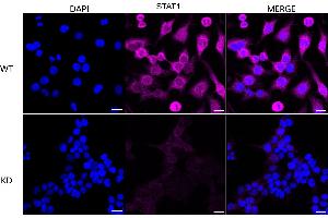 anti-Signal Transducer and Activator of Transcription 1, 91kDa (STAT1) antibody