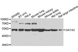 Western blot analysis of extracts of various cell lines, using GATA2 antibody. (GATA2 antibody  (AA 1-300))