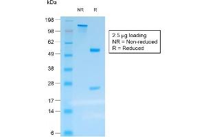 SDS-PAGE Analysis Purified Chromogranin A Mouse Recombinant Monoclonal Ab (rCHGA/413). (Recombinant Chromogranin A antibody)