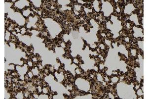 ABIN6264405 and ABIN6274040 at 1/100 staining Mouse lung tissue by IHC-P. (PRC1 antibody  (Internal Region))