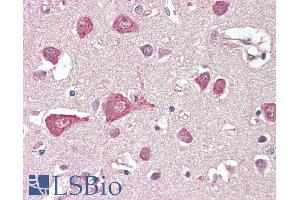 ABIN1590116 (5µg/ml) staining of paraffin embedded Human Cortex. (MLC1 antibody  (AA 179-193))