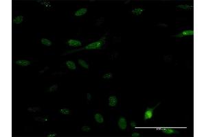 Immunofluorescence of monoclonal antibody to PDE5A on HeLa cell. (PDE5A antibody  (AA 29-138))