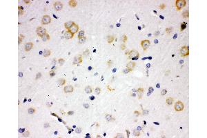 Anti-PAK6 antibody, IHC(P) IHC(P): Rat Brain Tissue (PAK6 antibody  (N-Term))