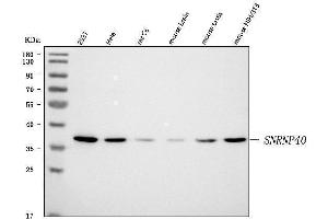 Western blot analysis of SNRNP40 using anti-SNRNP40 antibody (ABIN7601719).